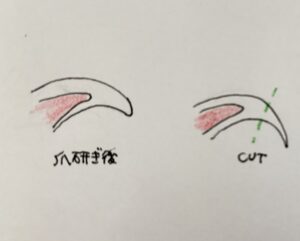 保護猫初心者の爪切り